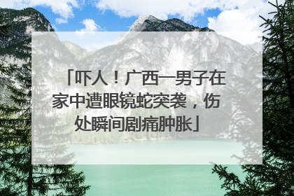 吓人！广西一男子在家中遭眼镜蛇突袭，伤处瞬间剧痛肿胀